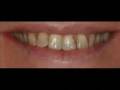 videos de Movie 0015