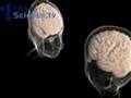 The difference between men and women's brains