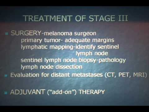 Later Stage Melanoma Treatment – MetroHealth