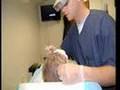Dr. John Frank Hair Transplant Services