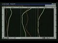 Dr. Amalu on Chiropractic Thermography 1/3 Dr. Amalu on Chiropractic Thermography 1/3