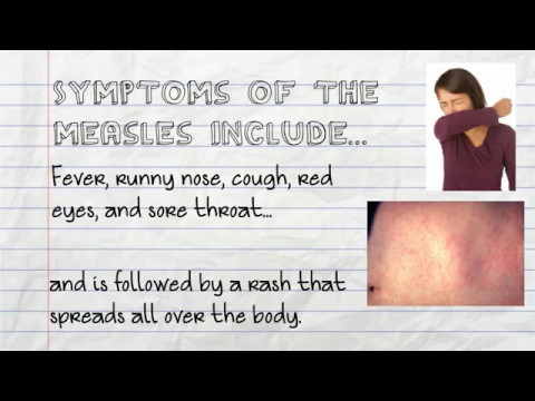 how to avoid measles