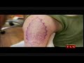 Chris Garver Tattoos Shortarmguy