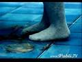 comercial cancer