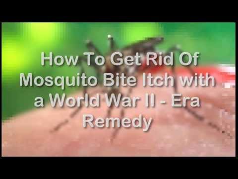 how to get rid itchy bug bites
