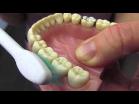 Putztechnik Schallzahnbürste