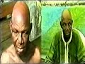 Miracles in Nigeria 14 - Back Cancer Miracles in Nigeria 14 - Back Cancer