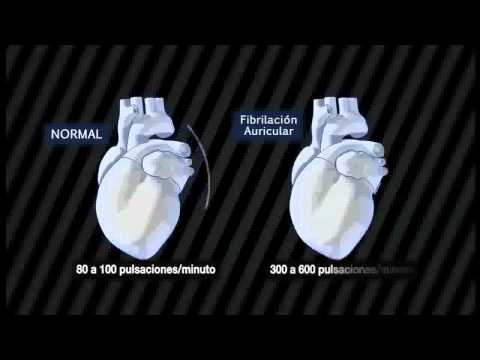 Imagen de previsualización de YouTube