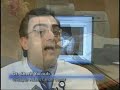 Intensity Modulated Radiation Therapy  Radiation Therapy Radiotherapy