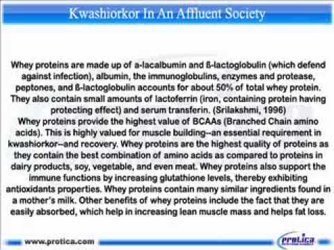 how to treat kwashiorkor