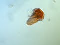 rotifer Philodina gregaria from Antarctis