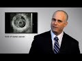 Douglas Faigel, MD, a gastroenterologist and director of therapeutic endoscopy at Mayo Clinic in Arizona, discusses endoscopic ultrasound (EUS), a procedure that utilizes ultrasound to capture images deep within the GI tract and also help physicians stage tumors.