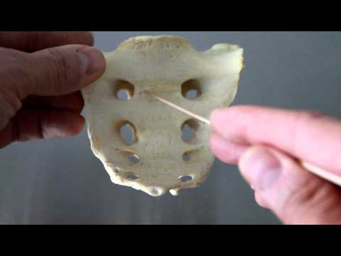 Sacral - Short video describing the skeletal structures of the sacrum Structural markings identified: Sacral promentory Transverse lines Sacral foramina Ala Auricular...
