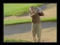 2: A Remarkable Hair Transplantation Reality pt.2 of 3 2: A Remarkable Hair Transplantation Reality pt.2 of 3