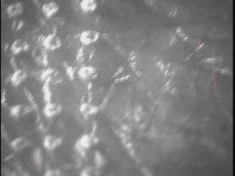 Fractional CO2 ablation; FDDA; ...