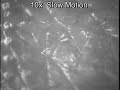 Fraxel Re:pair CO2 laser High Magnification Fraxel Re:pair CO2 laser High Magnification