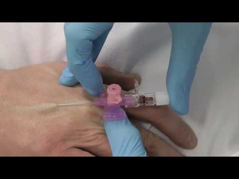 how to perform iv insertion