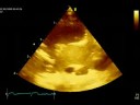 Feline Echocardiography--Spontaneous Contrast Feline Echocardiography--Spontaneous Contrast