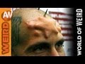 World of Weird - Skull Implants