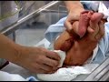Muda y limpieza de Cordón Umbilical