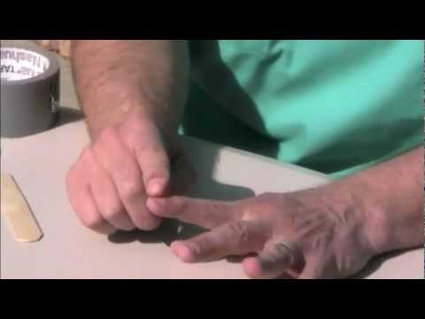 how to treat jersey finger