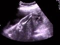 4D Ultrasound 28 Weeks Part 2