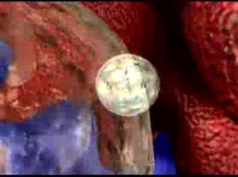 See video