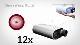 The Gynocular - a mobile colposcope for detection of cervical cancer
