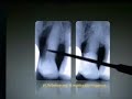 Perioscopy Case Presentations