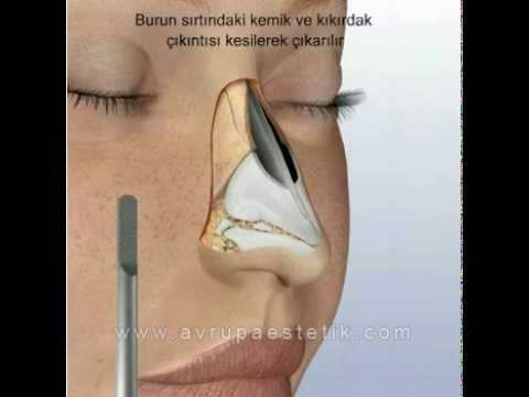 burun