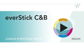 Fibre-reinforced composite bridge with everStick C&B – posterior