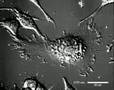 Treadmilling Macrophage