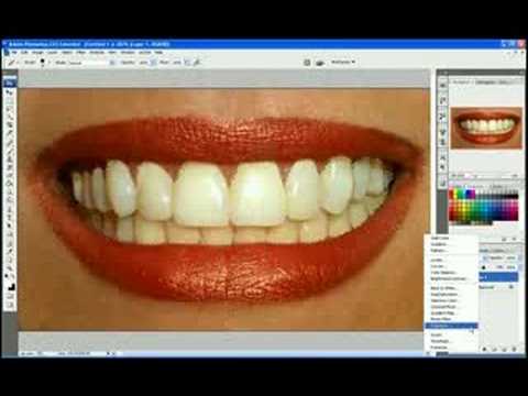 how to whiten my teeth in a photo