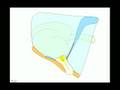 videos de ABDOMEN AGUDO OBSTRUCTIVO 2