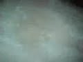 condom foot