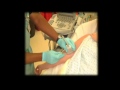 Ultrasound Guidance Central Line
