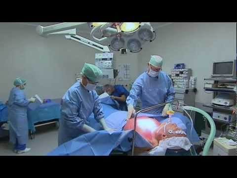 Borstverkleining (man) door dr. B van der Lei in tv serie Dit is mijn lijf 