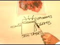 How to Identify Skin Cancer Signs : What Causes Melanoma Skin Cancer? How to Identify Skin Cancer Signs : What Causes Melanoma Skin Cancer?