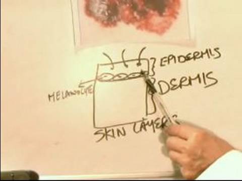 how to id skin cancer