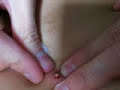 Big Bad Blackhead