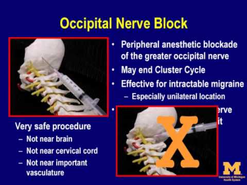 how to cure cervicogenic headache