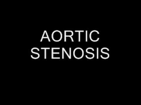 aortic stenosis