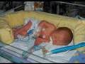 32 week Preemie Samuel's Month in NICU and Year