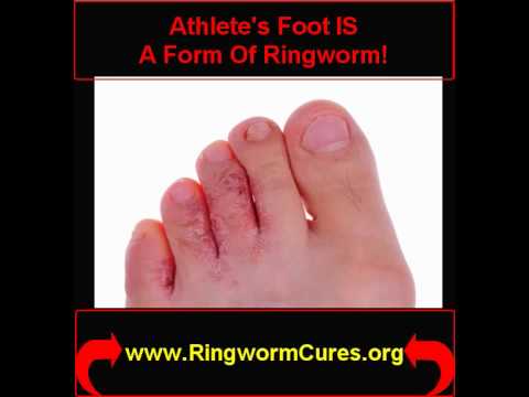 how to control ringworm in humans