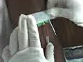 CANULACION DE LA LDA RAIZA FINOL, CANULA UNA PROTESIS, PACIENTE MARITZA,,,,