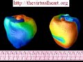 ventricular tachycardia, simulation in rabbit ventricles