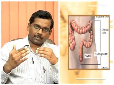 how to treat esophageal ulcer