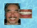 Implant Dentistry