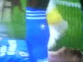 John Terry - Chelsea - Knocked Out - Carling Cup Final-head