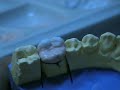 molar